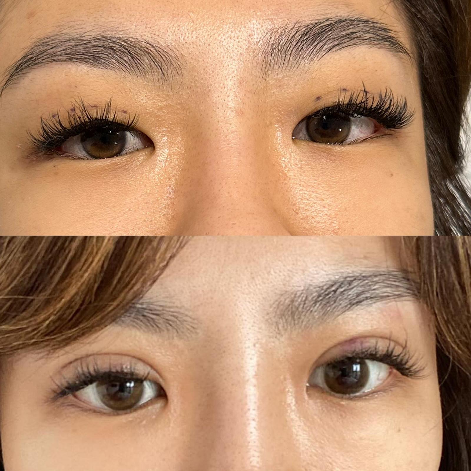 Anti-wrinkle treatment planning in a premium clinic